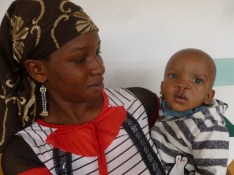 Amadou BAH postop (6) (Small)