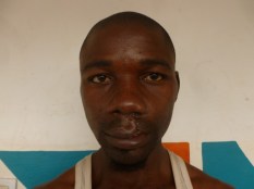 Etienne CAMARA postop (1) (Small)